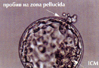 Оплождане и развитие на ембриона в ин витро условия